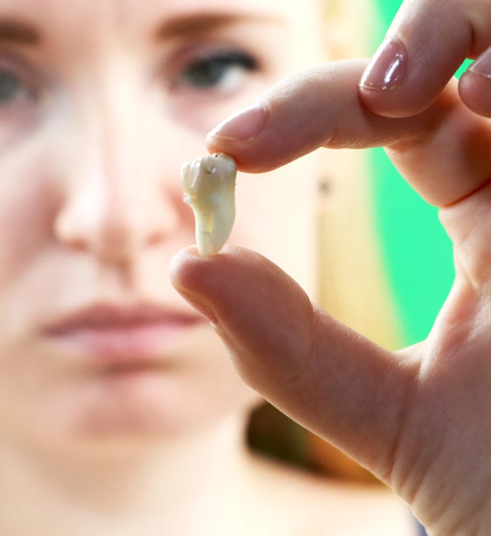 when should you get your wisdom tooth removed?